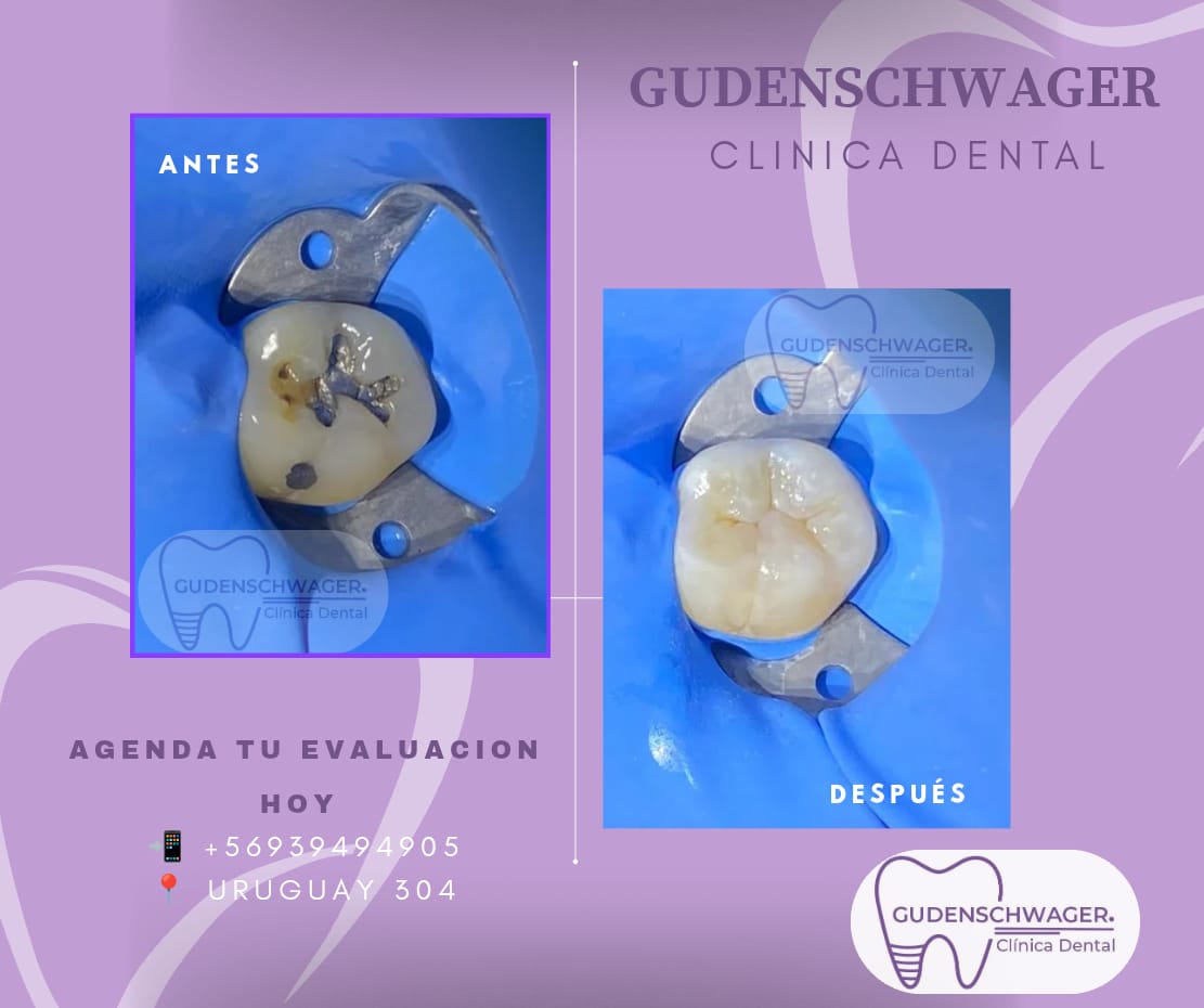 Clinica Dental Gudenschwager